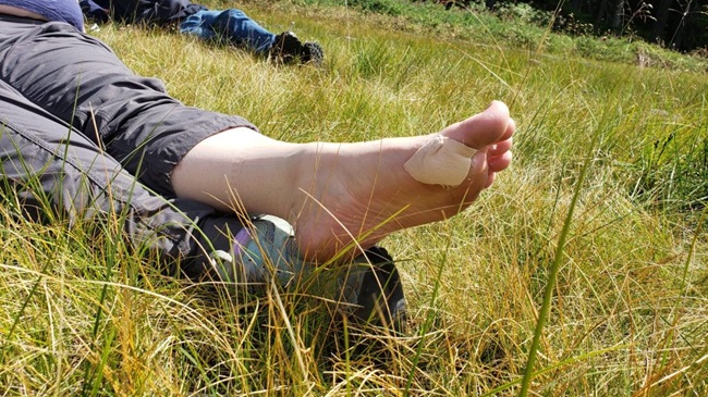 blisters while camping and hiking